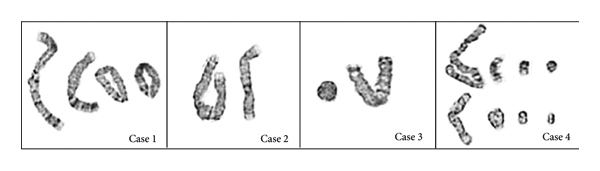 Ring Chromosomes.jpg
